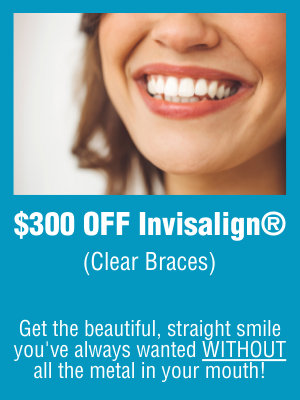 $300 Off Invisalign