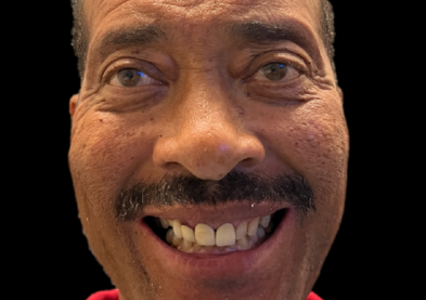 Teeth Xpress (Before)