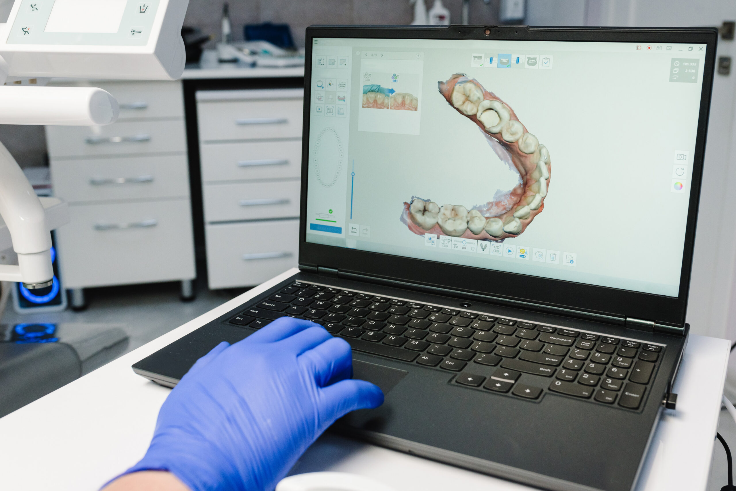 Doctor looking at 3D scan of patients' teeth on a laptop